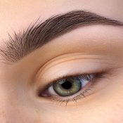 Glaucoma sintomas iniciales