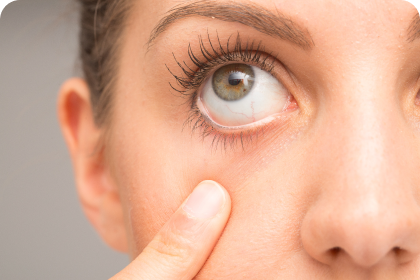 mujer abriéndose el ojo con un dedo