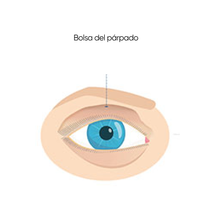 ojo antes de blefaroplastia