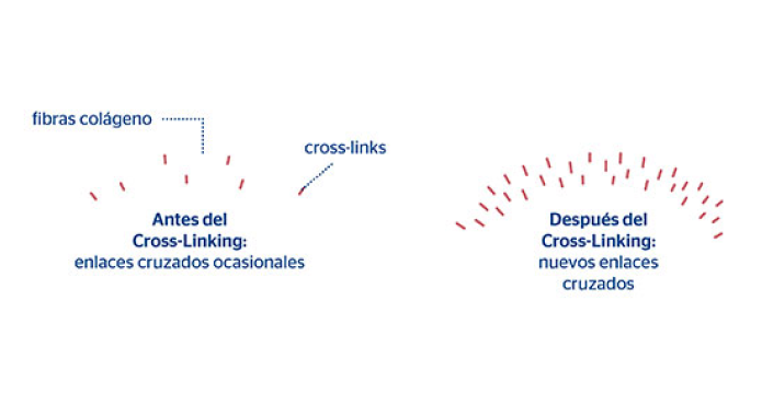 antes y después del crosslinking corneal