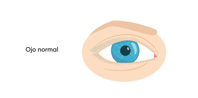 ojo normal sin pterigión