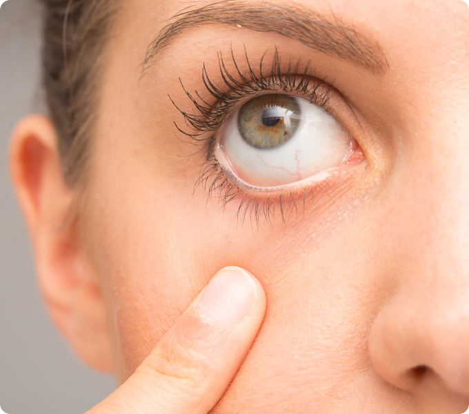 mujer abriéndose el ojo con un dedo