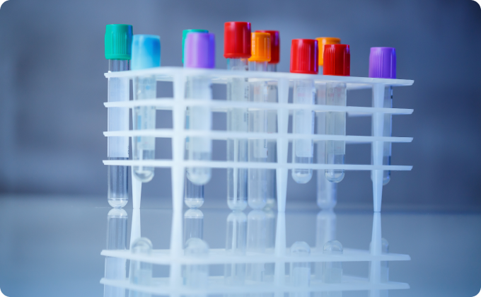 tubos de muestras de laboratorio