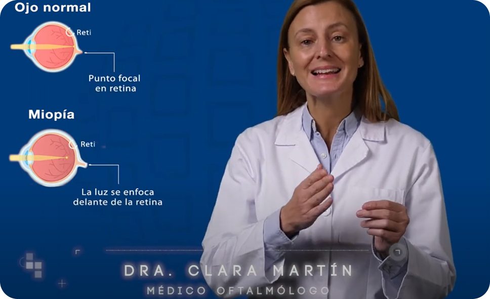 La Dra. Clara Martín en un momento del video explicativo sobre la miopia